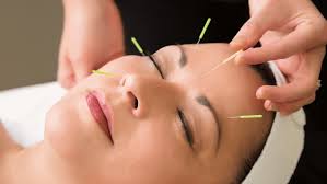 The Healing Power Of Acupuncture: Benefits, Techniques & Effects